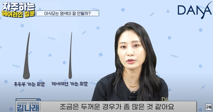 Is It Hard to Dye Transplanted Hair After Hairline Correction? image 4