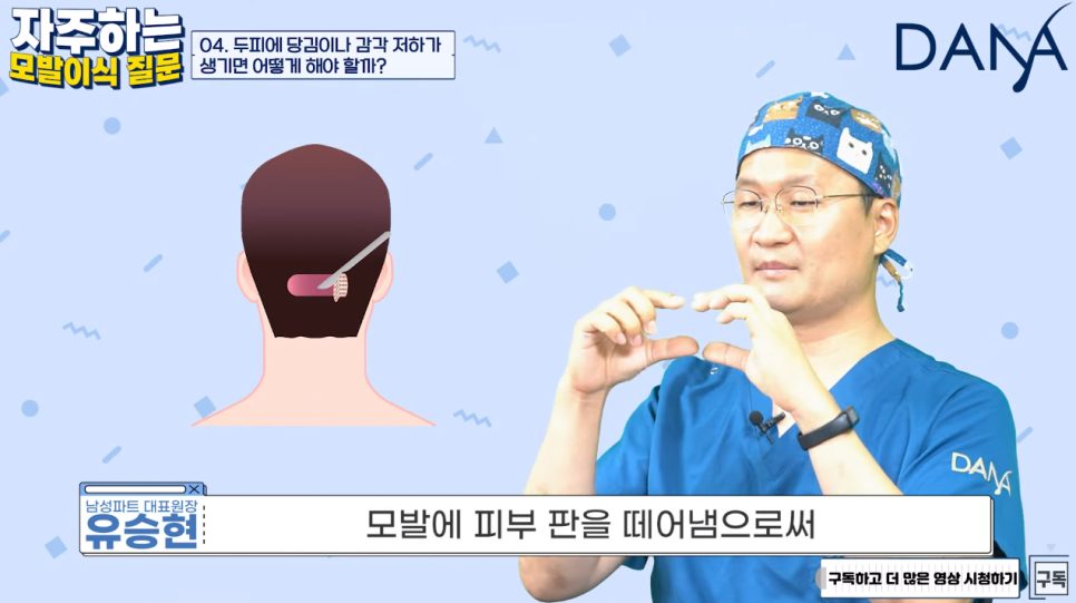 모발이식 수술 후 가장 궁금해하는 질문들 Q&A 관련 이미지 13