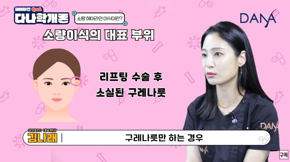 헤어라인교정 소량(적은모수)으로도 가능할까 관련 이미지 3