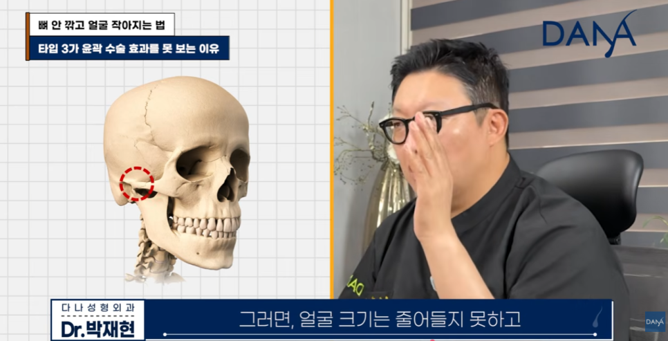 뼈 안 깎고 얼굴 작아지는 법? 광대 수술 효과 없는 관련 이미지 14