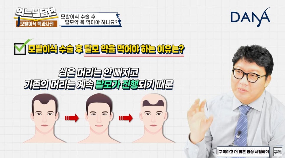 Do I Need to Keep Taking Hair Loss Medication Even After Hair Transplant Surgery? image 3