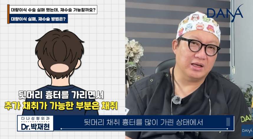 해외 원정 모발이식! 조심스럽게 만류하는 이유 관련 이미지 7