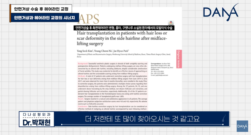 안면거상술 후 흉터와 헤어라인 변형, 자연스럽게 해결하는 방법 관련 이미지 7
