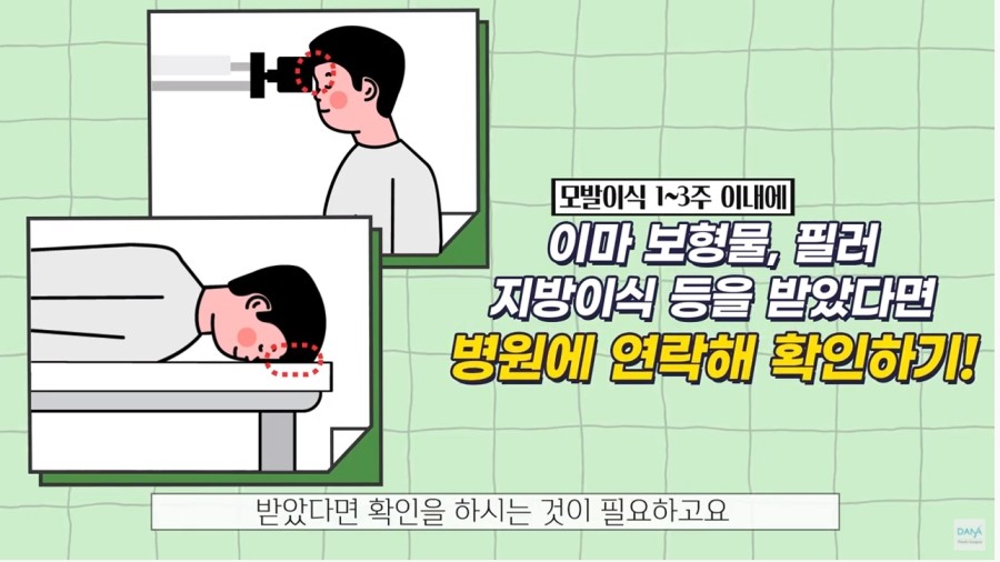 모발이식수술 전 미리 병원에 꼭 알려야할 체크리스트 관련 이미지 6