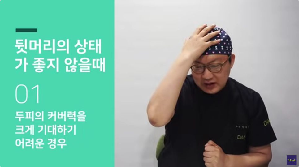 Cases Where You Should Not Get Hair Transplant Surgery, Explained by a Hair Transplant Clinic Doctor image 2