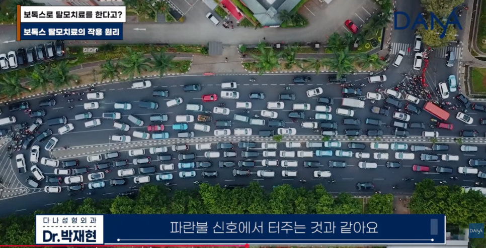 여성 탈모 치료, 먹는 약 대신 두피 보톡스 맞아야 하는 이유 관련 이미지 9