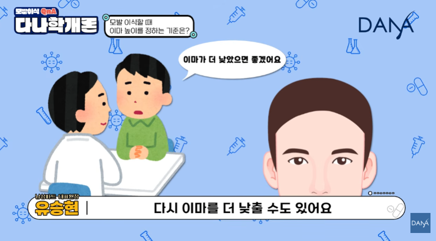 모발이식 이마 높이 정하는 기준! 무작정 낮추면 안되는 이유 관련 이미지 5