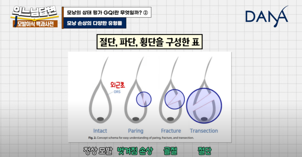 GQI의 문제점?! 관련 이미지 9