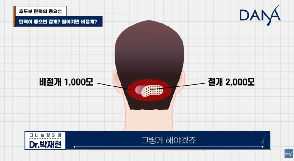 모발이식 전 관련 이미지 13
