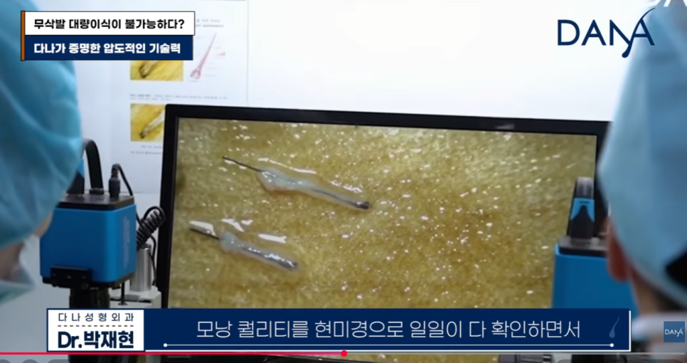 무삭발 모발이식이르 3000모 대량이식 가능할까? 생착률 높이는 진짜비밀 관련 이미지 16