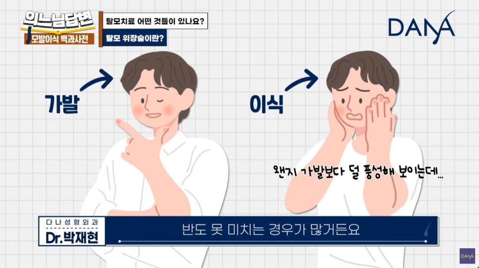 모발이식? 가발? 건강관리? 탈모치료의 종류_2편 관련 이미지 6