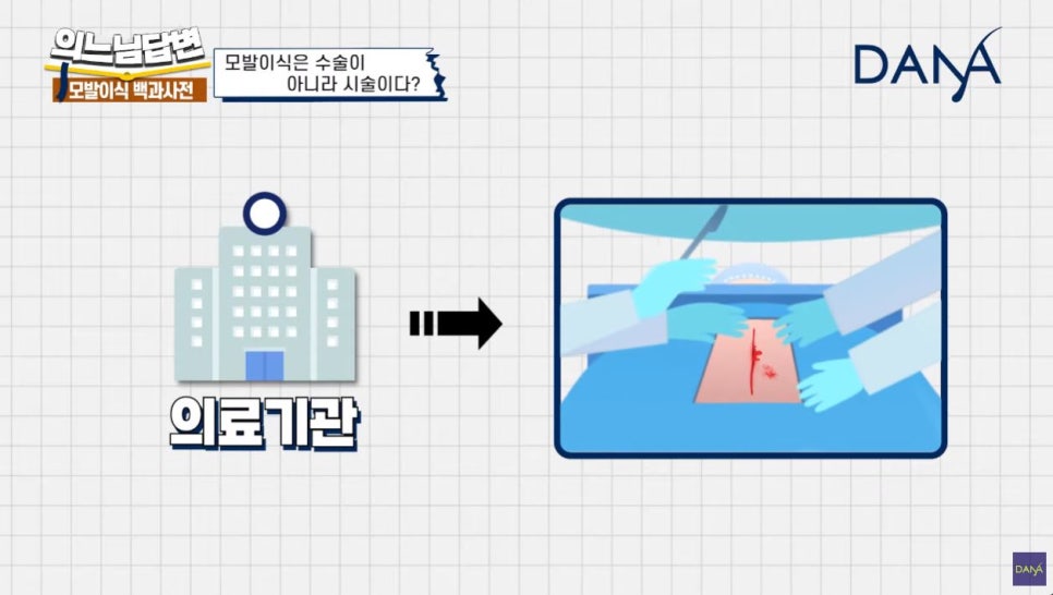 모발이식, 수술일까? 시술일까? 관련 이미지 4