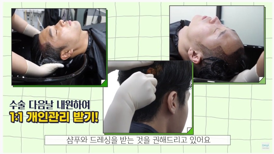 Checklist of Precautions for Days 1–3 After Hair Transplant Surgery image 7