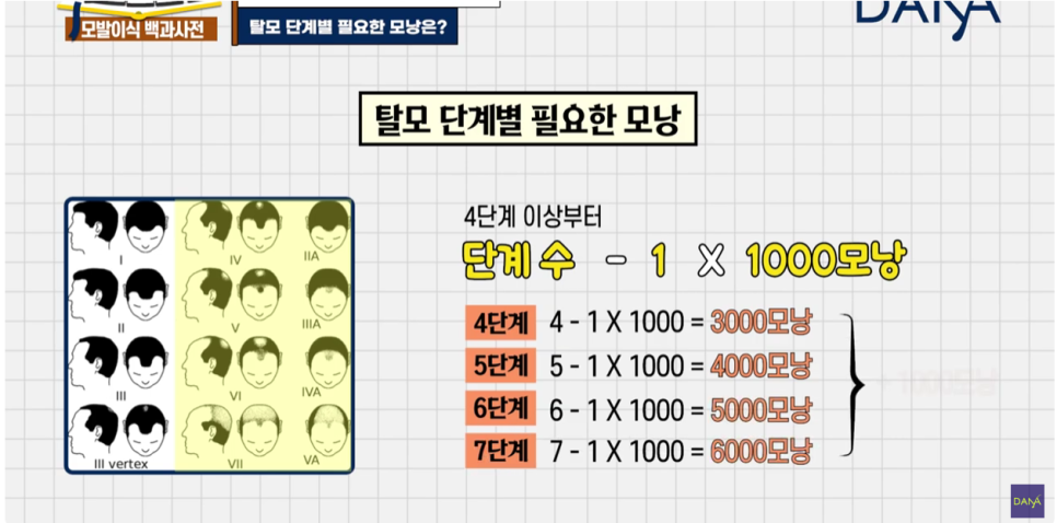 체모이식 체모를 활용한 단계별 대량이식 관련 이미지 10
