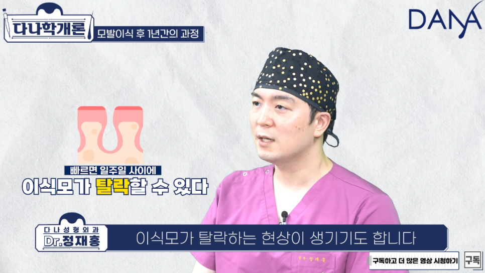 모발이식 1년후 (수술후 머리카락이 자라나는 과정) 관련 이미지 5