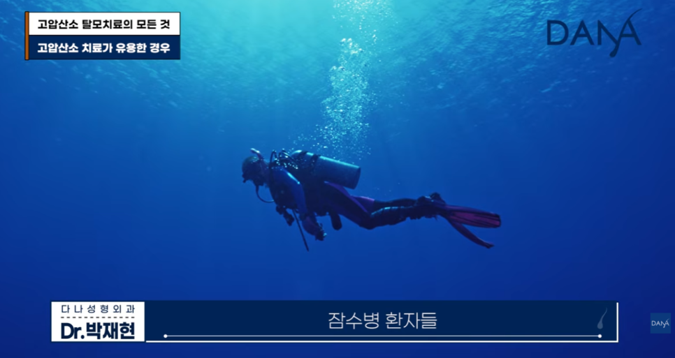 고압산소 탈모치료 돈 낭비일까? 부작용부터 효과까지 총정리 관련 이미지 11
