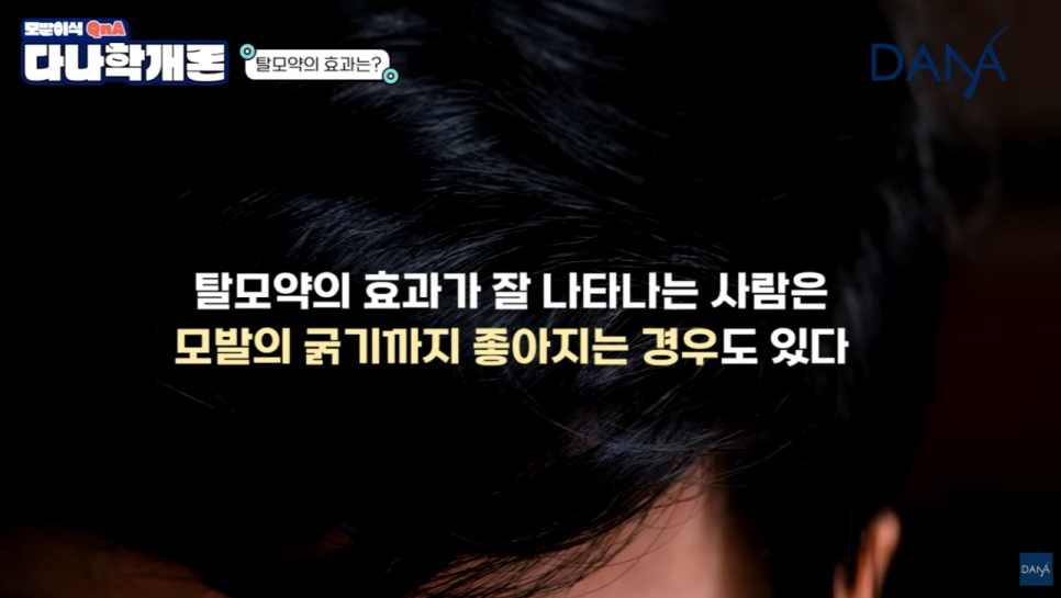 탈모약 효과가 없다고 느껴진다면? 올바른 탈모약 복용법과 기대 효과 3가지 관련 이미지 7