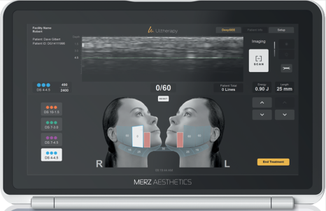 What Has Changed in the Effects and Pain of Ultherapy Prime? image 4