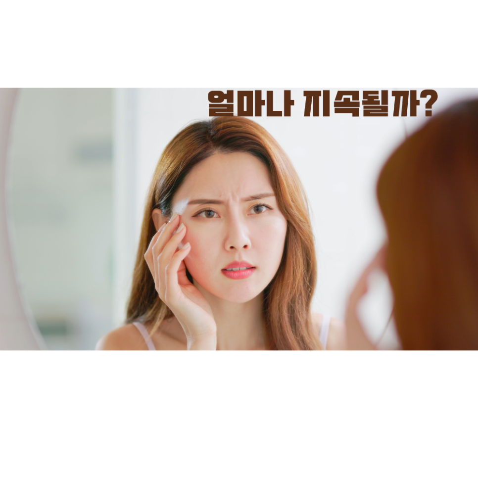 울쎄라 붓기 언제까지 가나요 관련 이미지 3