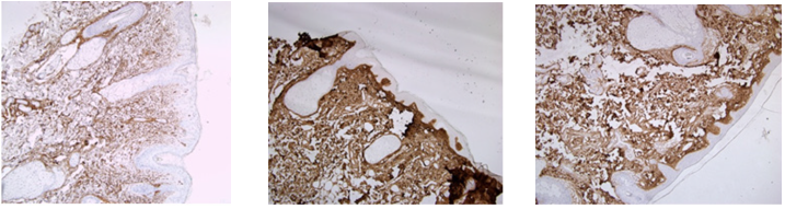 Collagen Booster Radiesse: Principles and Effects (Part 2) / Gangnam Sinsa Station Dermatology image 3