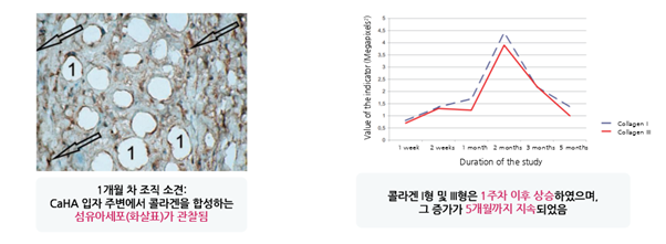 디클래시 용량 및 회차별 효과, 시술 전 알아둘 기준 관련 이미지 9