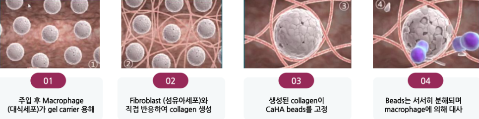 디클래시 효과, 시술 후 피부는 어떻게 달라질까 관련 이미지 2