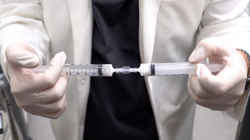 Why the Effects of Radiesse Should Be Viewed Differently from Fillers image 1
