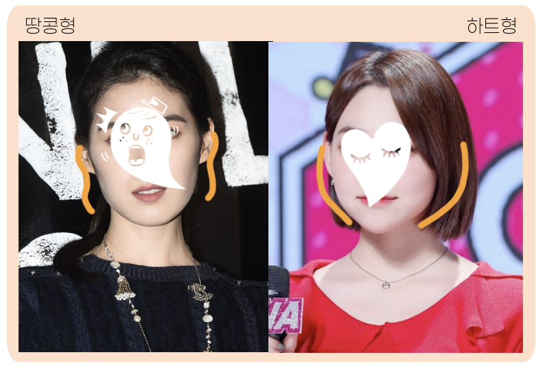 땅콩형 얼굴, 얼굴살 없는 사람은 울쎄라 하면 안될까?/ 강남신사역피부과 관련 이미지 1