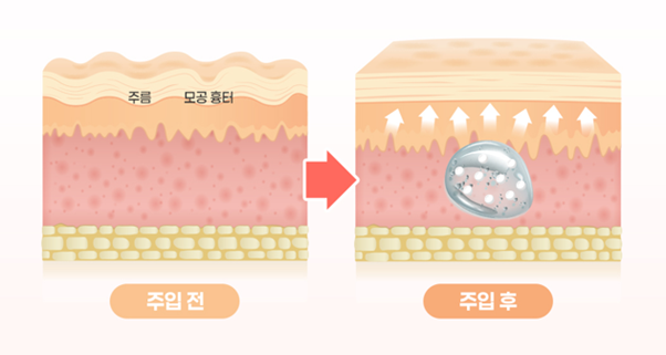 리프톤 피부과 리투오 Expert Clinic 선정, 결과가 달라지는 이유 관련 이미지 10
