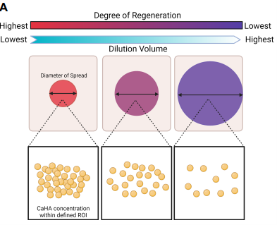 Collagen Volume Booster Radiesse (Part 3) / Gangnam Sinsa Station Dermatology image 4