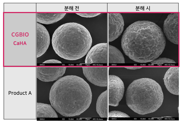 What Is Diclasy? Effects and Treatment Areas of the CaHA Collagen Booster image 9