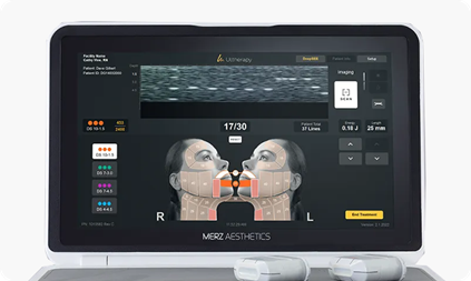 Ultherapy Prime: Facial Sagging Appears Differently Depending on the Area image 4