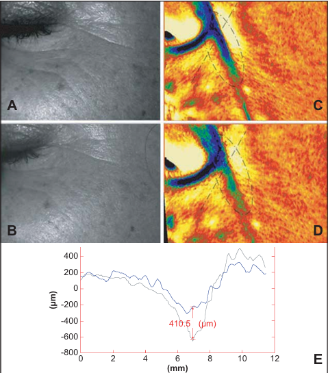 Lifton Dermatology Introduces TriLift ㅣ From Facial Muscles to Body Firmness image 7