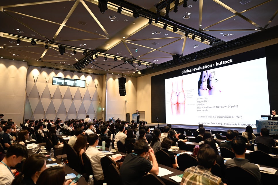 2025 KAAD 하계 학술대회 강연 후기｜Buttock 시술의 미용적 접근과 임상적 고찰 관련 이미지 10