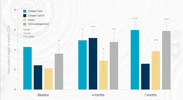 Why the Effects of Radiesse Should Be Viewed Differently from Fillers image 2