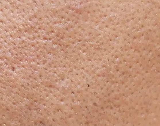 How to Reduce Pores image 1