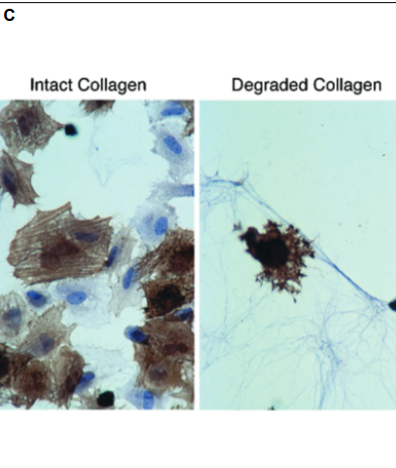 Collagen Booster Radiesse: Principles and Effects (Part 2) / Gangnam Sinsa Station Dermatology image 2