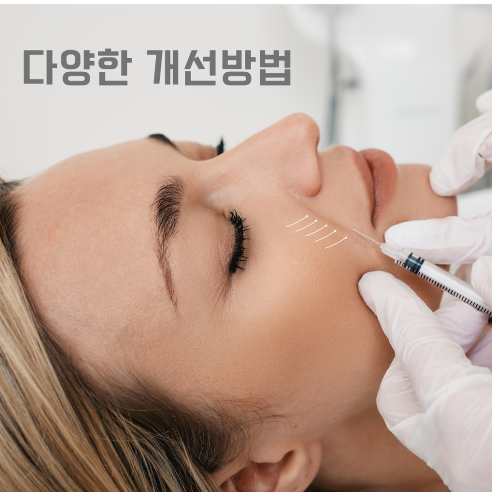 팔자주름 울쎄라 대표원장이 직접 알려드립니다 관련 이미지 4