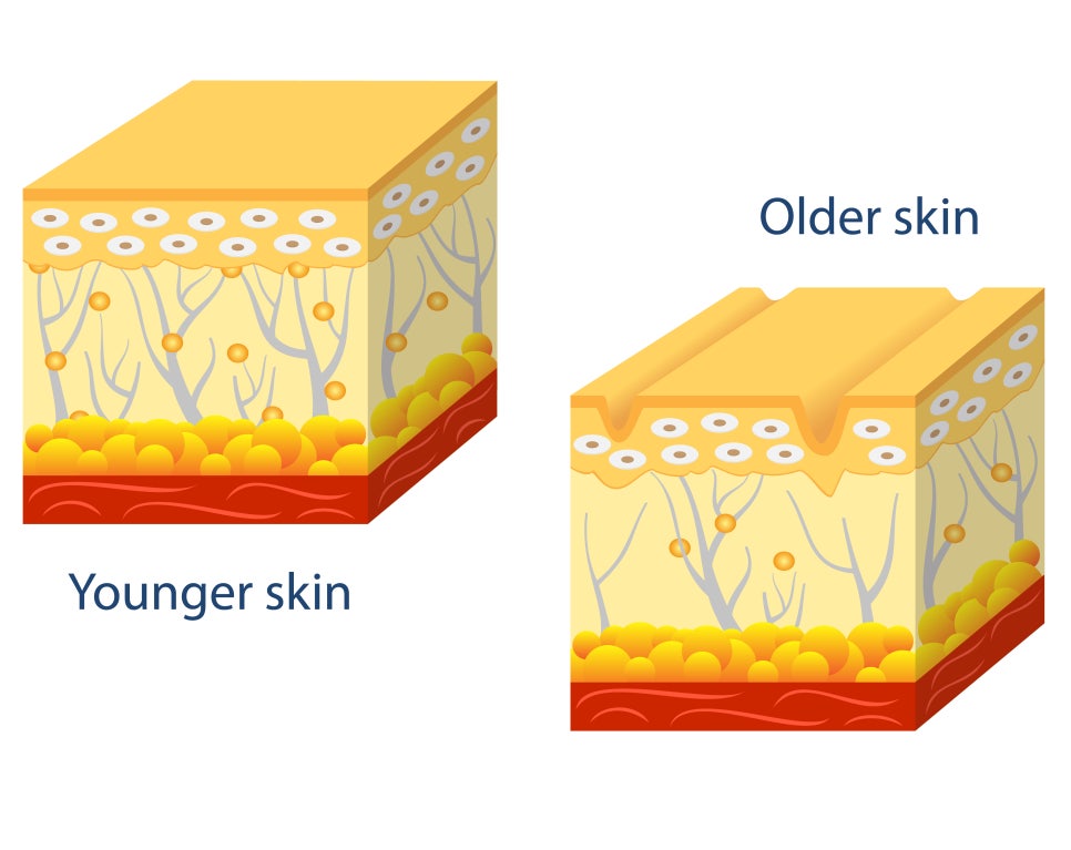 A Complete Guide to Ultherapy Prime Results: Key Points Analyzed Directly by a Dermatology Specialist image 1