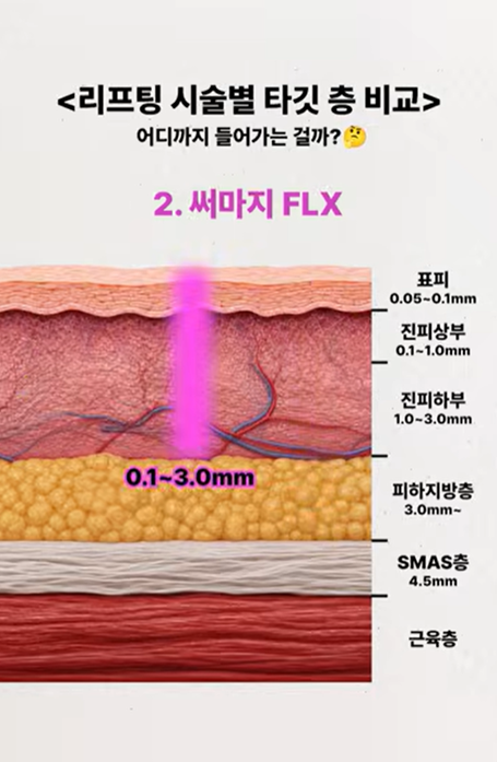 울써마지, 같이 하면 얼굴에 너무 강하지 않을까? 관련 이미지 4