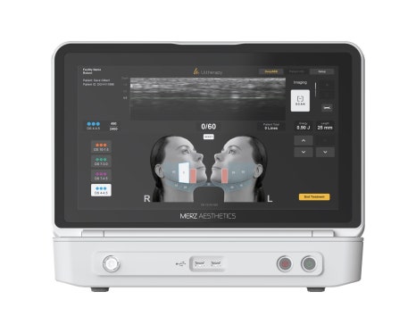 Ulthera Prime Sets a New Standard in Lifting Procedures image 2