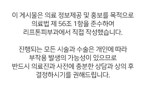 울써마지, 같이 하면 얼굴에 너무 강하지 않을까? 관련 이미지 10