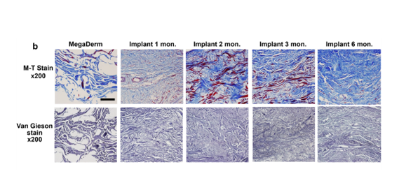 Rejuran vs. Lituo: What’s the Difference, and Which Procedure Is Right for My Skin? image 11
