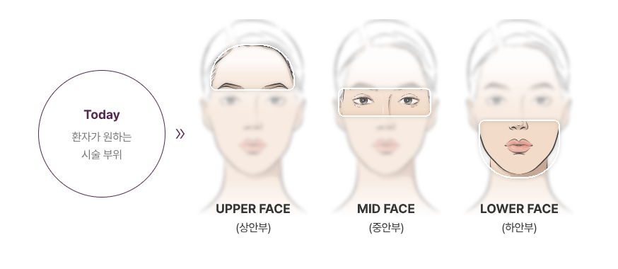 MD Codes로 살펴보는 쥬비덤 필러 시술 접근법 관련 이미지 3