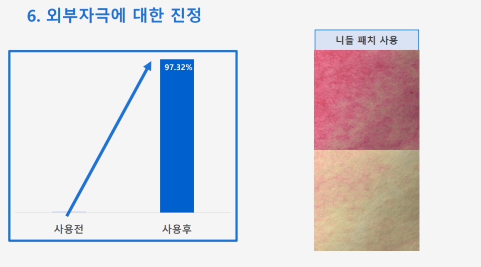 Anti-Aging Cosmetic with Dermatologist Expertise: 'Lifton Wrinkle Shot' Needle Patch Launched image 10