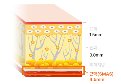 울쎄라 효과를 극대화 시키기 관련 이미지 2