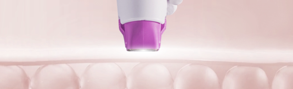 Sinsa Ulthera Prime — See the Core Differences from Thermage at a Glance image 4