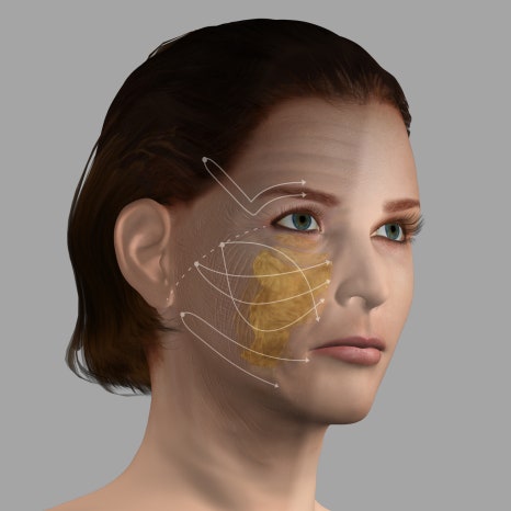A Complete Guide to Ultherapy Prime Results: Key Points Analyzed Directly by a Dermatology Specialist image 8