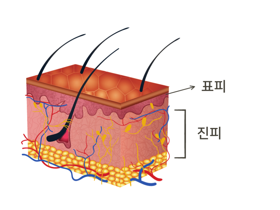 울쎄라 써마지 차이 전격 비교해 드립니다 관련 이미지 3