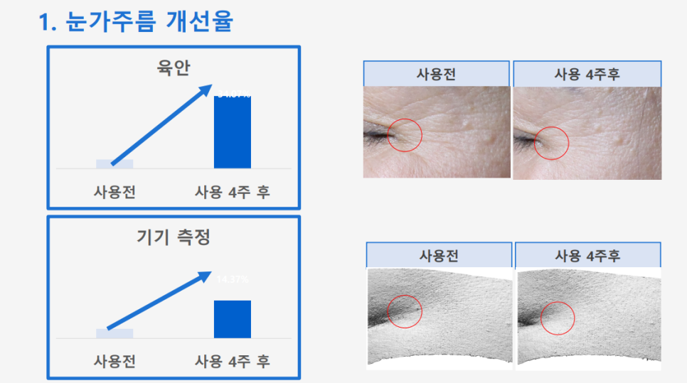 Anti-Aging Cosmetic with Dermatologist Expertise: 'Lifton Wrinkle Shot' Needle Patch Launched image 5